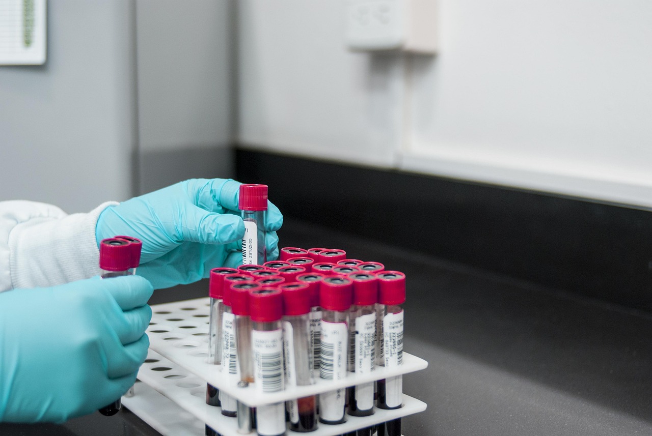 Mulher realizando coleta de sangue para exame de hemoglobina glicada