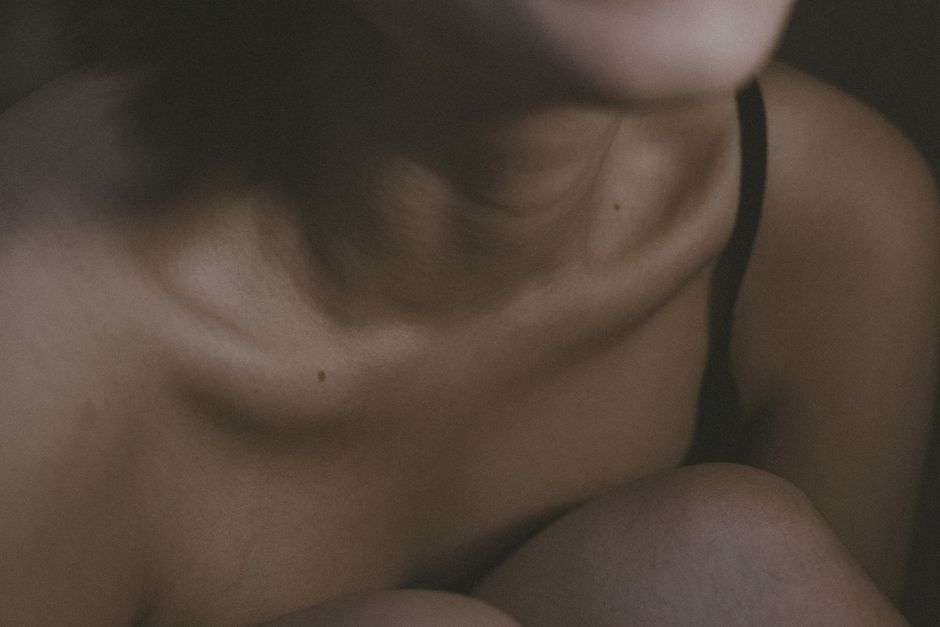 Manchas escuras no pescoço e axilas, sinal visual de resistência à insulina e risco de diabetes